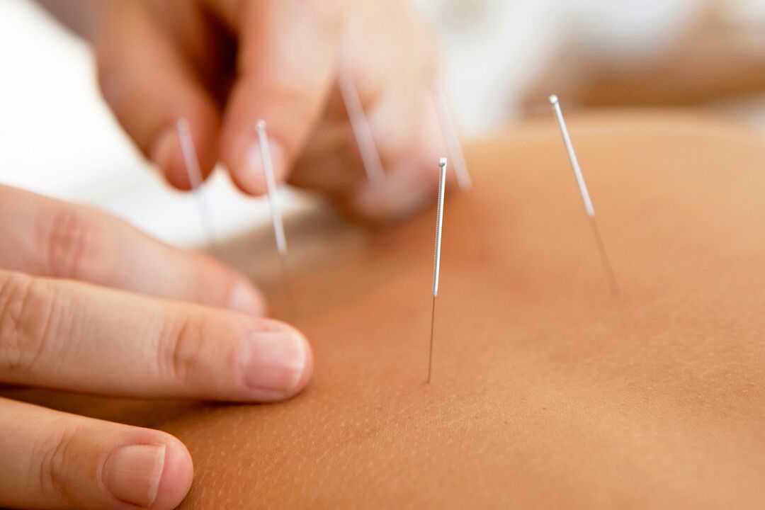 akupunktur for at øge styrken