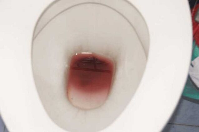 pletblødning hos mænd, når de er ophidsede